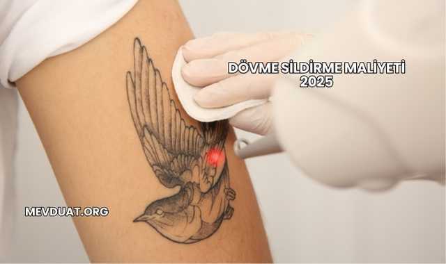 Dövme Sildirme Maliyeti 2025